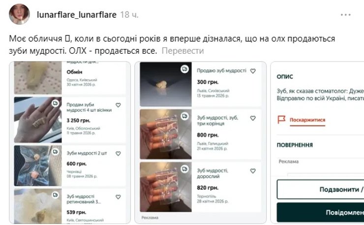 Зуби мудрості продаються в Україні