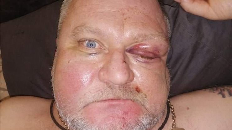 нападение на депутата горсовета