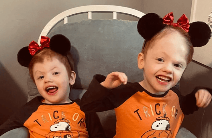 Сросшиеся близнецы, близнецы, близнецы Дилейни, рискованная операция, детский сад, разделение близнецов, сросшиеся черепа