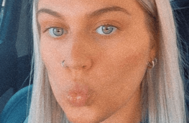 Дівчина, жінка, ударила блискавка, пережила удар блискавки,