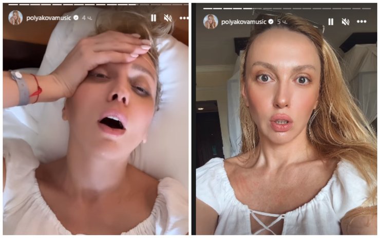 Оля Полякова пожаловалась на плохое самочувствие на отдыхе