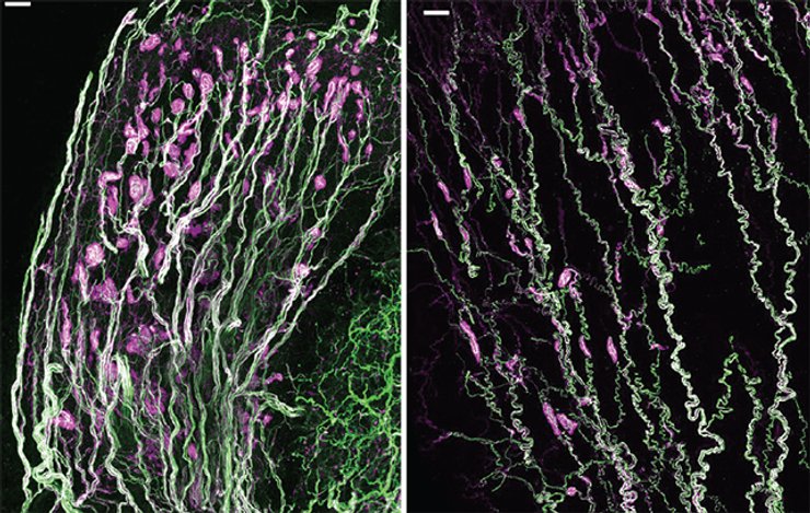 нерви, клітор, головка