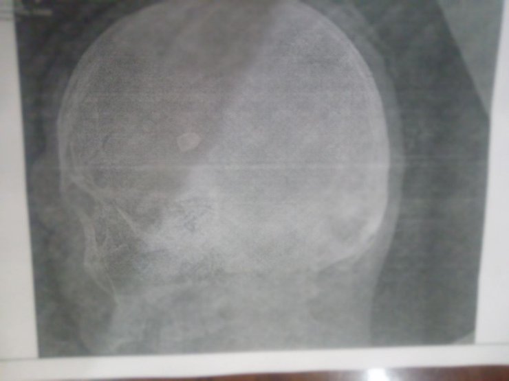 Куля, Ігор Мангушев