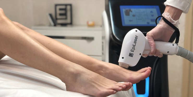 эпиляция ног