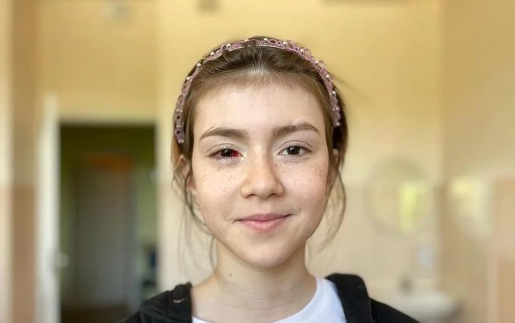 операція на оці