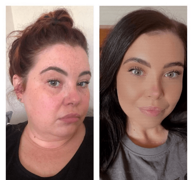 Жінка скинула 63 кг завдяки TikTok, схуднення, операція, зайва вага, скинула зайву вагу, об'їдалася шоколадом, потрапила в пастку