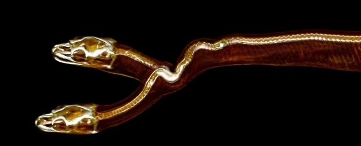 рентген змеи