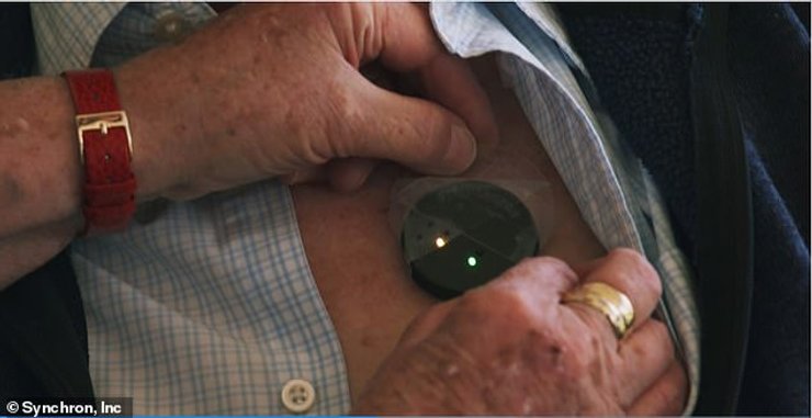 чіпування, мозок