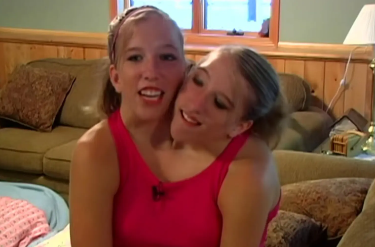 Признание отцовства, суд, сиамские близняшки, Джошуа Боулинга, курьезы, США, интересные истории