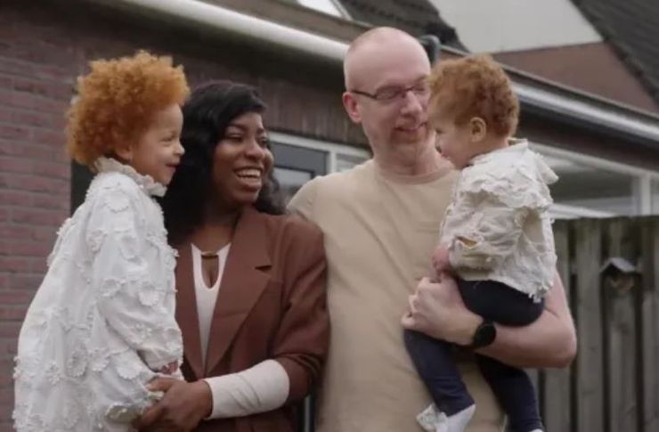 У темношкірої жінки народились білі діти з рудим волоссям, як це могло статися