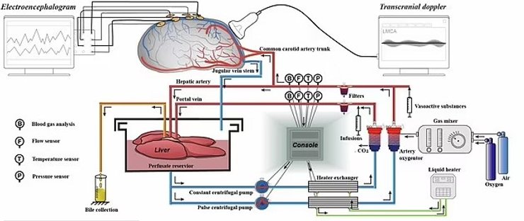 система життєзабезпечення