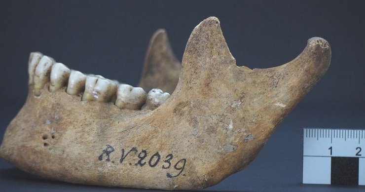 Нижняя челюсть человека