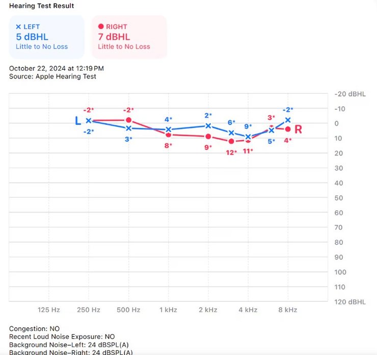 Навушники AirPods Pro 2, перевірка слуху, проблеми зі слухом