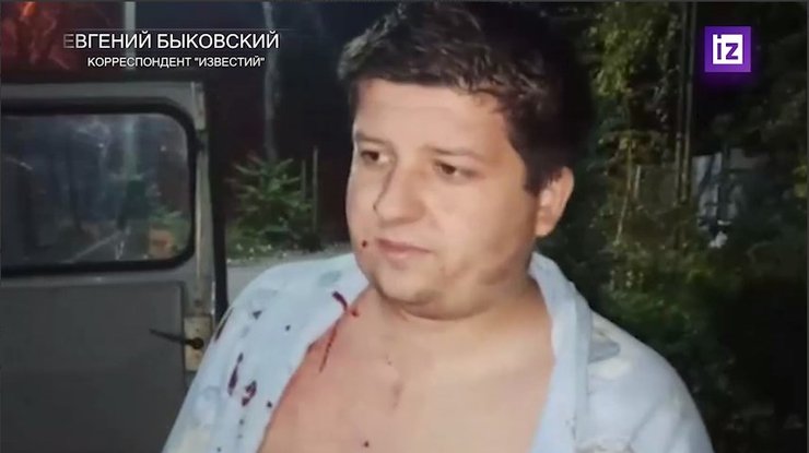 корреспонденты россми попали под обстрел, обстрел донецка, российские журналисты, россми