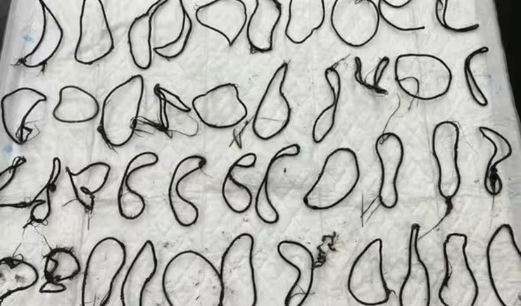 Гумки для волосся, кішка, домашня тварина, таємно хворіла, рентгенівський знімок, зробили операцію, гумки для волосся, ветеринари,