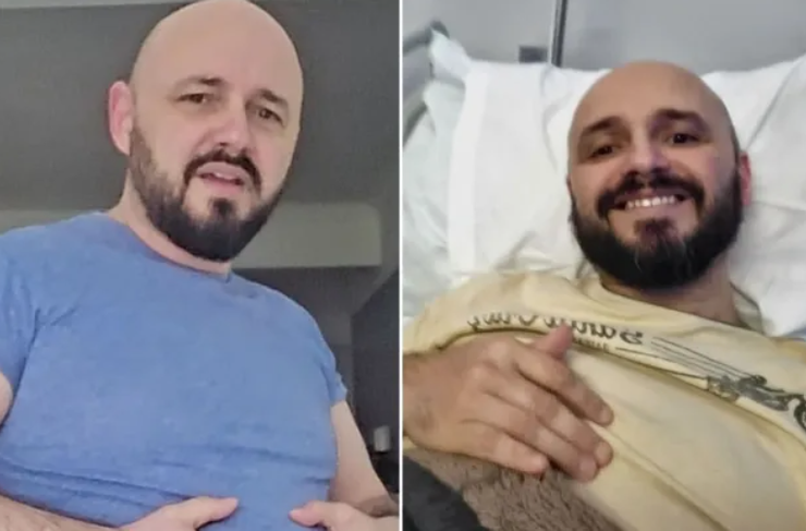 Чоловік з грижею має вигляд, наче на 7 місяці вагітності, Пол Мілхем, Велика Британія, операція