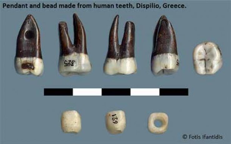 череп, амулет, трепанація, смерть, хірургія, удача, дух, знахідка, неоліт, підвіска, капала, предки, археологія, археологи, історія, культура