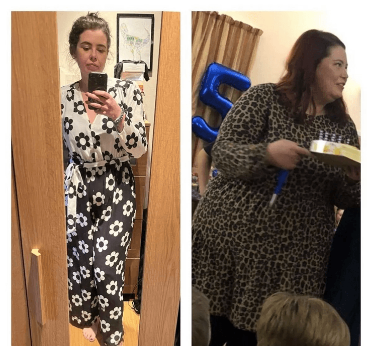 Жінка скинула 63 кг завдяки TikTok, схуднення, операція, зайва вага, скинула зайву вагу, об'їдалася шоколадом, потрапила в пастку