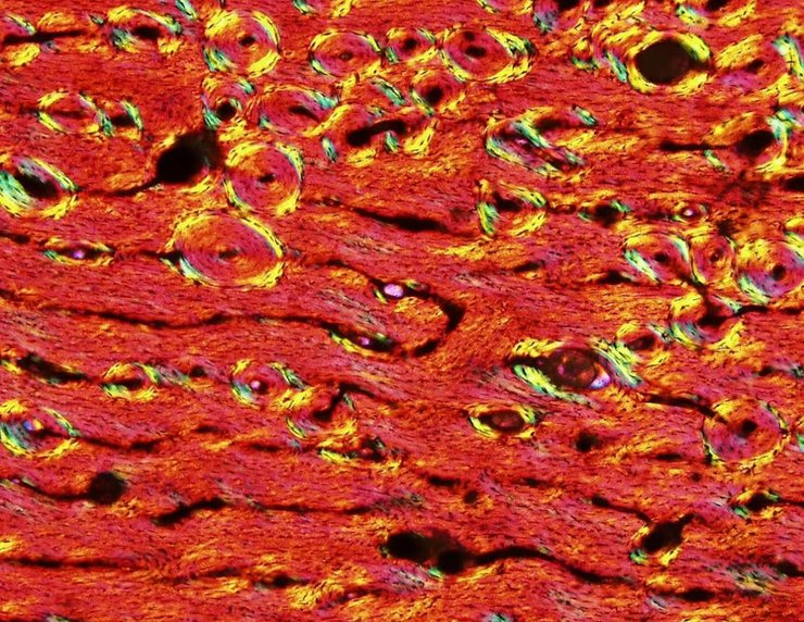 титанозавр срез кости