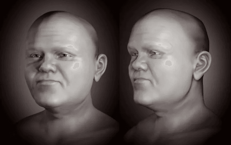 Реконструкція середньовічної карликовості, череп, методи реконструкції обличчя, карликовість, візуалізація історичної постаті, центральноєвропейський чоловік, давні черепні рештки, історична антропологія, 3D моделювання