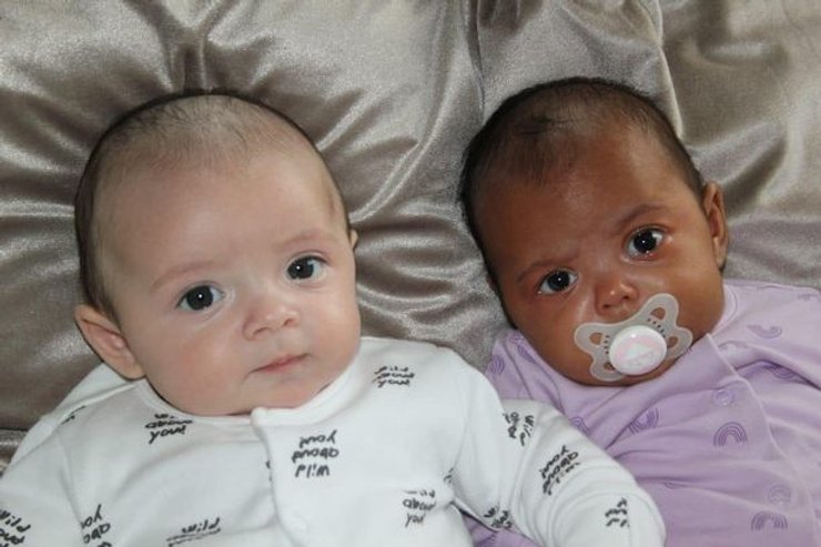 діти, шкіра