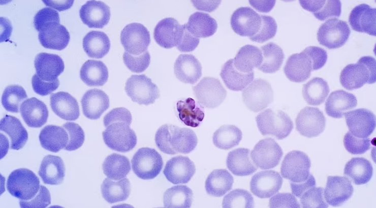 Клетка, Plasmodium malariae