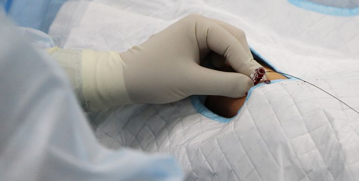 Малоинвазивная диагностика, кардиохирургия, операция на сердце