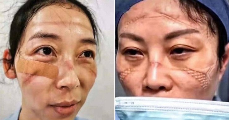 медработники, Китай, коронавирус