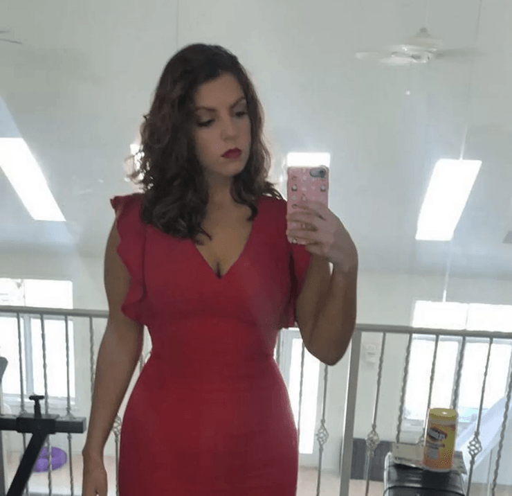 Жінка з рідкісною хворобою, жінка, хвороба, рідкісна хвороба, симптоми, YouTube, операція, зробила ліпосакцію