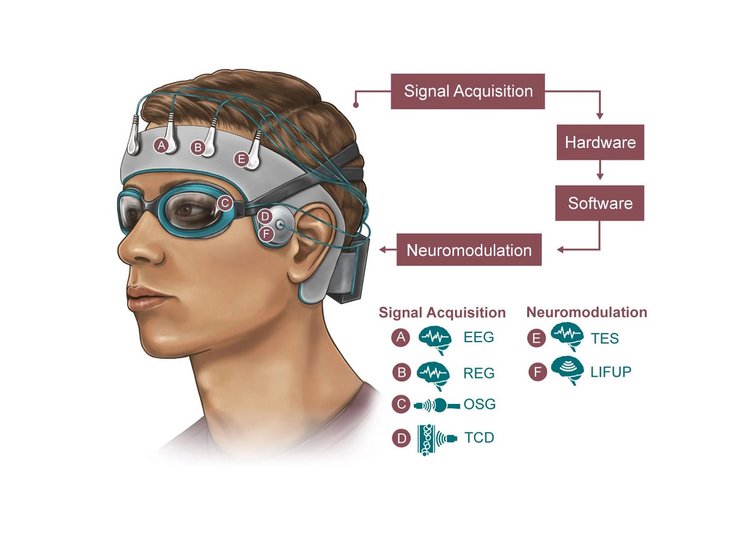 пристрій, нейромодуляціі