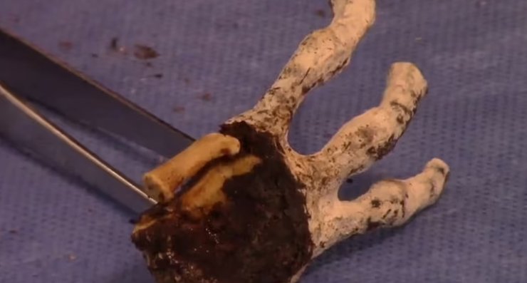 мумия, перу, инопланетянин