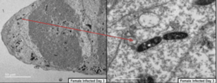 Черная Смерть, чума, болезнь, люди, паразиты, блохи, бактерия, возбудитель, Yersinia pestis, Ерсиния, яйца, передача, заражение, ученые, исследования, блохи, кровь