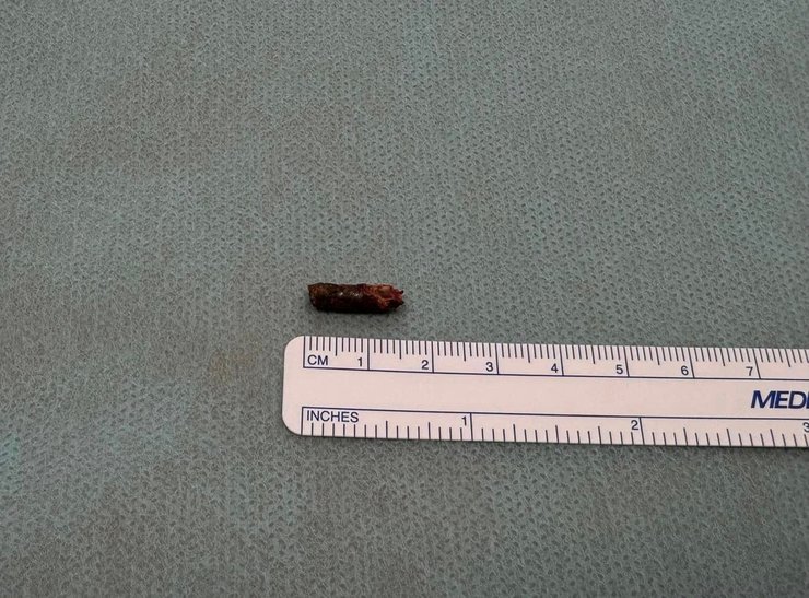 осколок із серця