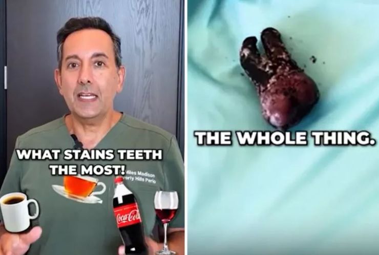 Какой напиток больше всего портит эмаль и цвет зубов, эксперимент, чай, кофе, вино, кола