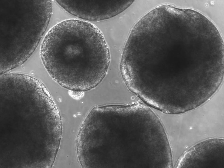 органоиды, мозг, неандертальцы