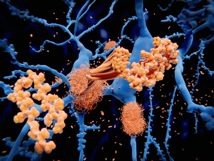 амилоид, сосуд, нейрон