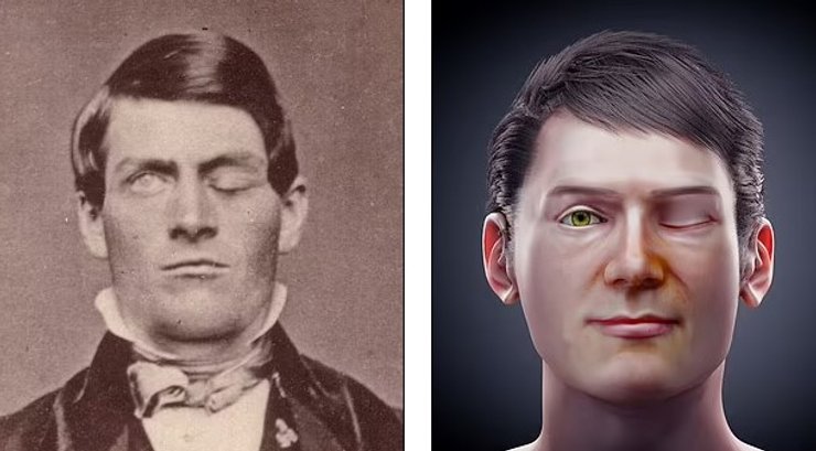 Финеас Гейдж