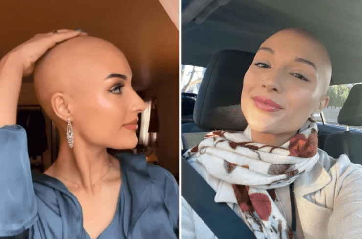 Элизабет Севиньи из Нью-Джерси, США, полностью облысевшая, женщина приняла участие в конкурсе красоты