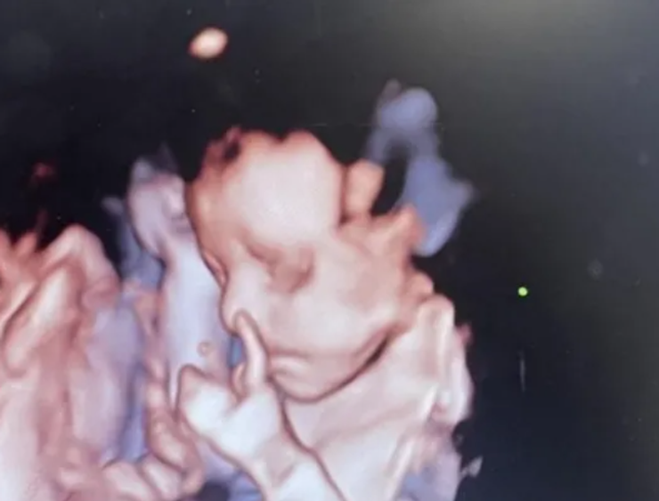 УЗИ во время беременности, рождение ребенка, курьезы, приколы, Мэдди Лундстрам, фото, Великобритания