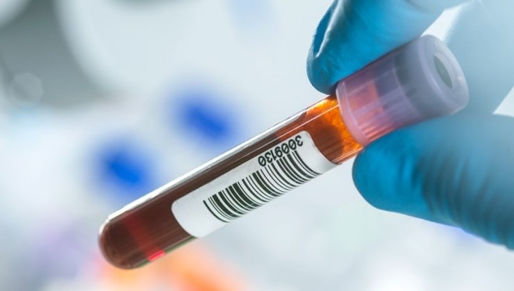 анализ крови