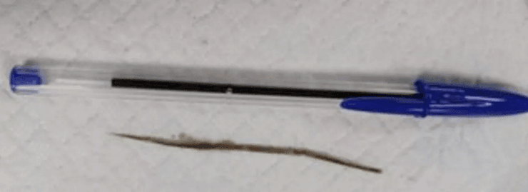 Кот чихал две недели, кот, домашнее животное, трава застряла в носу кота, растение в носу животного, ветеринары, ручка и травинка,