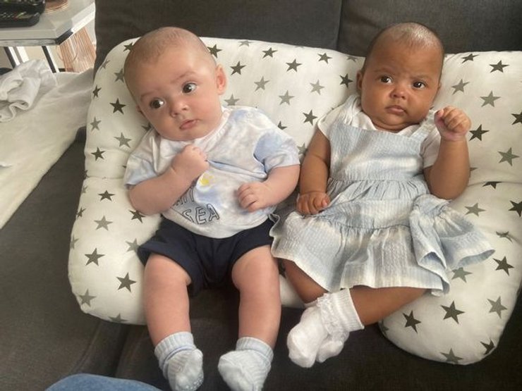 дівчинка, хлопчик, шкіра