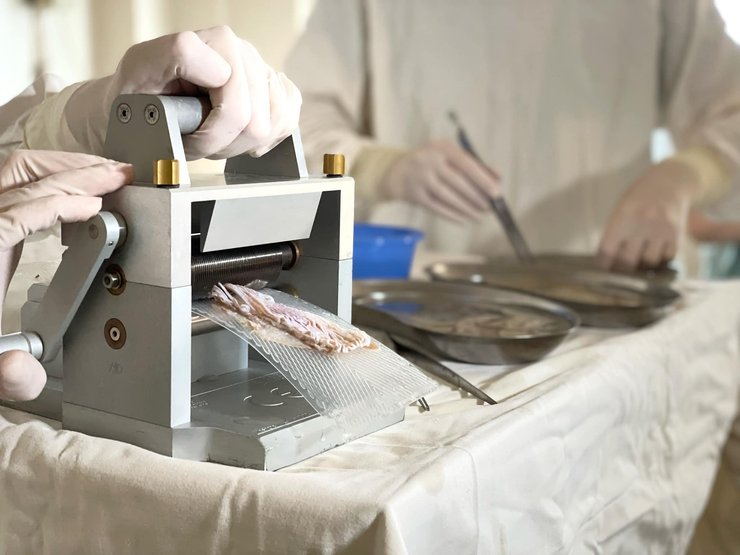 пересадка кожи, трансплантация, операция, врачи, медики