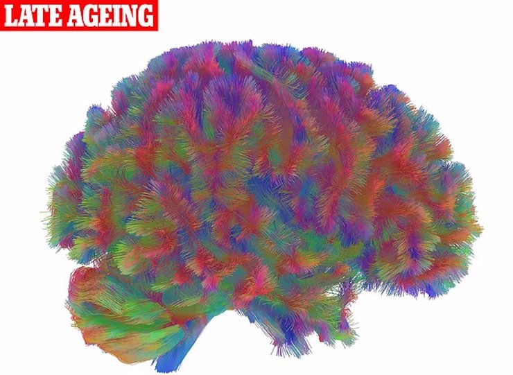 пізнє старіння мозок