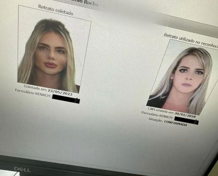 Дівчина змінилася до невпізнання за допомогою пластики