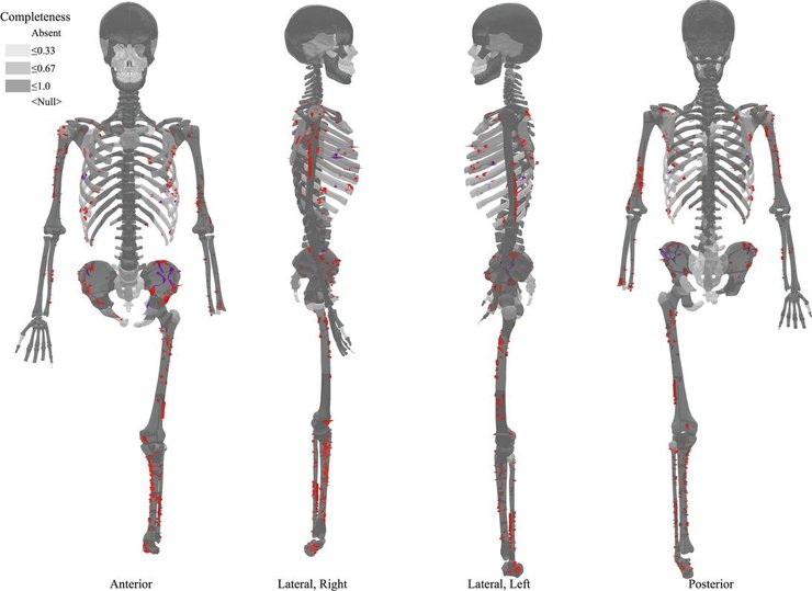 скелет, япония, народ дземон, травмы
