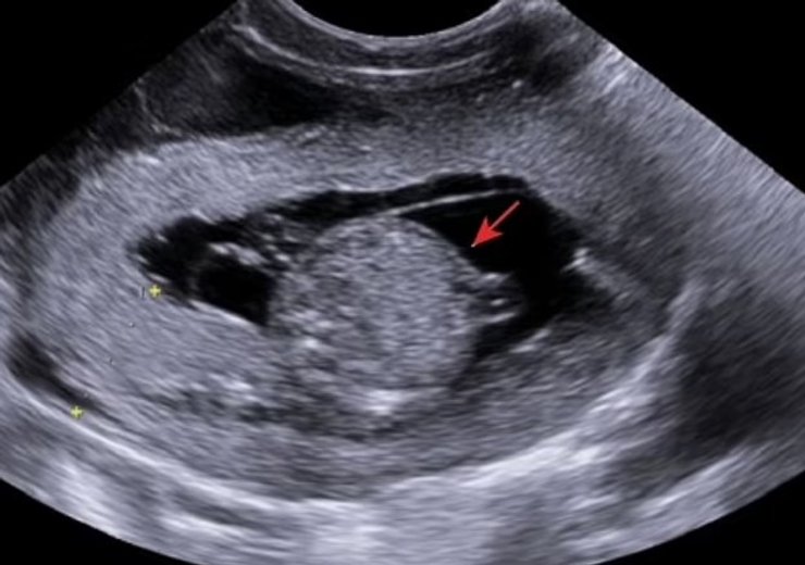 клонування ембріон