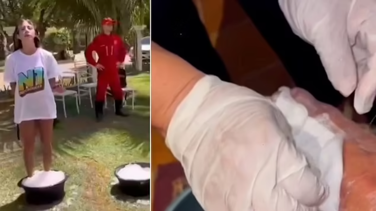 Ампутація пальців на нозі, участь у челенджі, курйози, реаліті-шоу, Бразилія, фото, скандал, небезпечні розваги