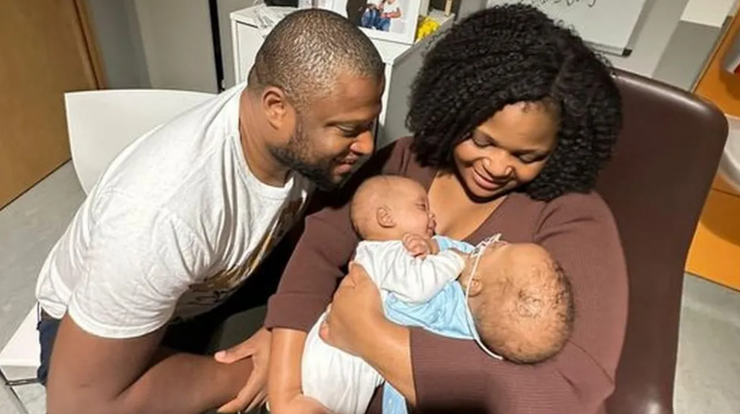 Сіамських близнюків з Великої Британії роз'єднали, операція, хірургія, діагнози