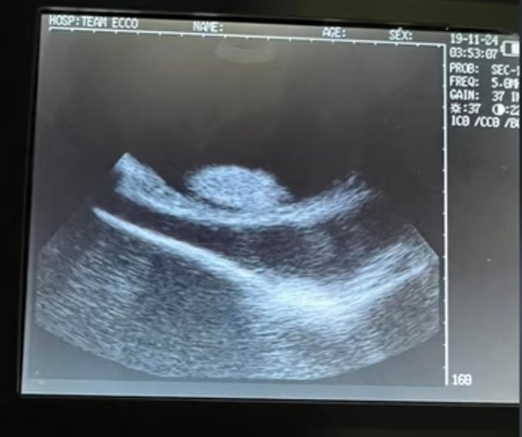 скат шарлотта узи